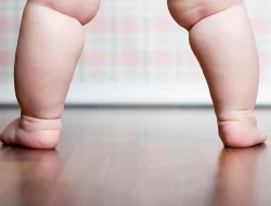 Obesitas Pada Bayi dan Anak, Perlukan Dilakukan Diet?